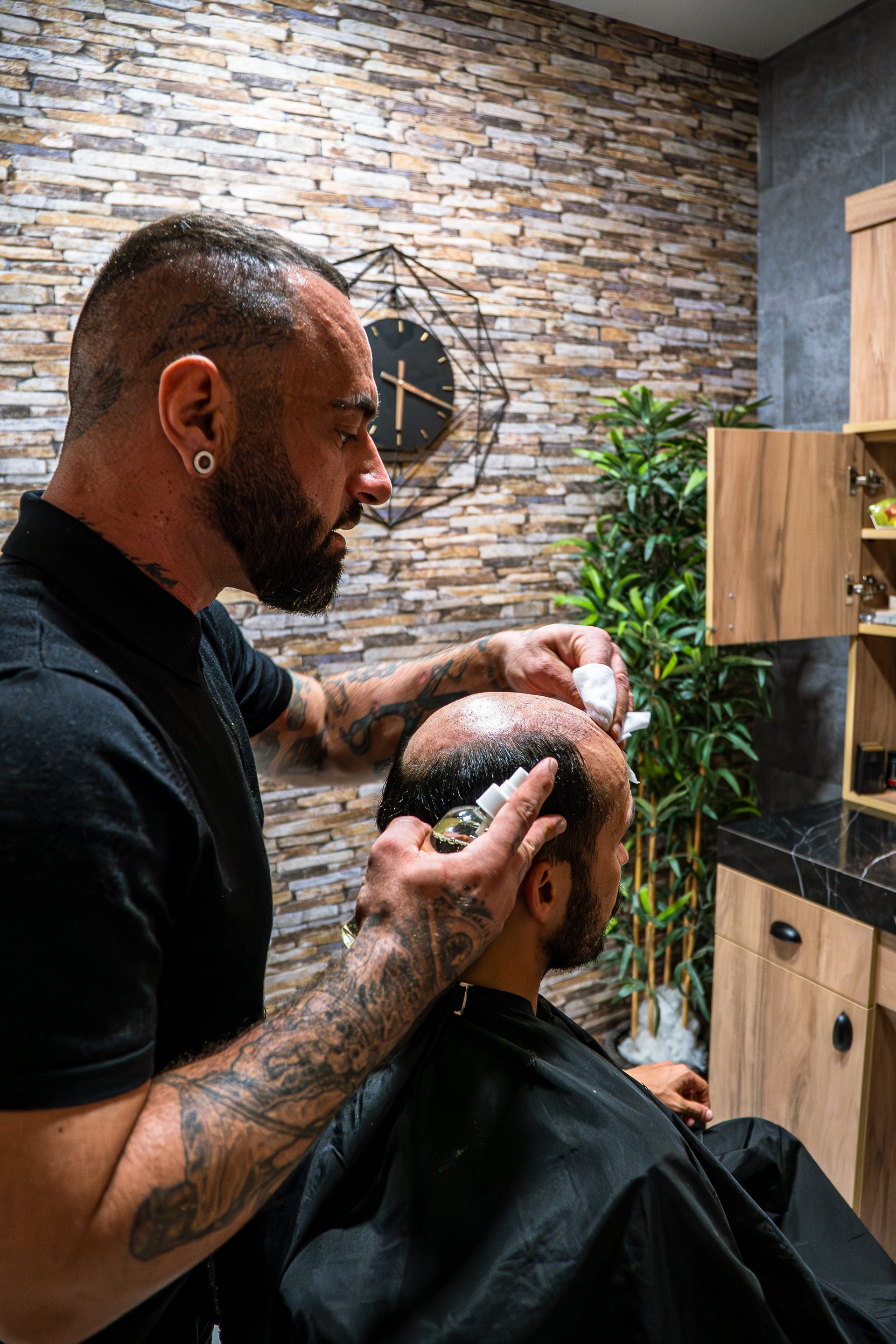 Aplicación de adhesivo profesional en coronilla para sistema capilar en Madrid